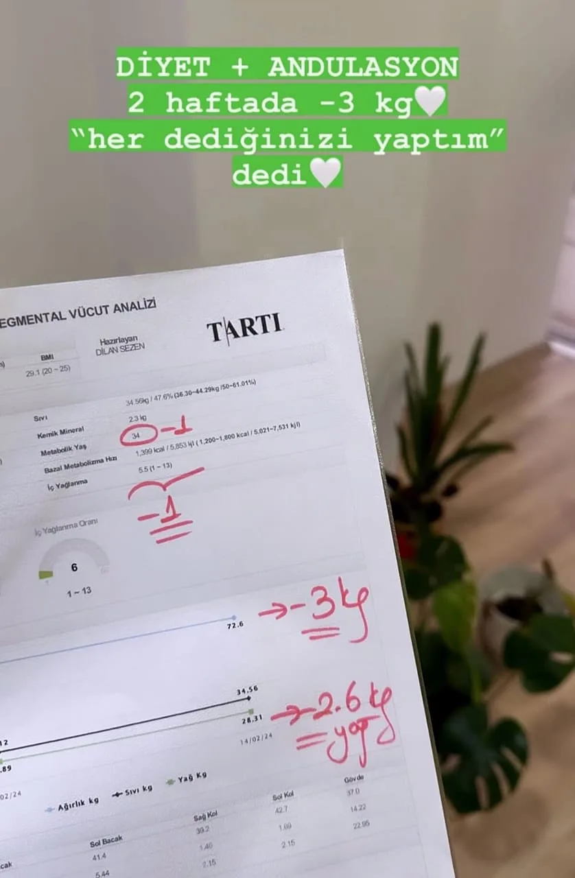 Diyetisyen Dilan Sezen - Andulasyon Terapi